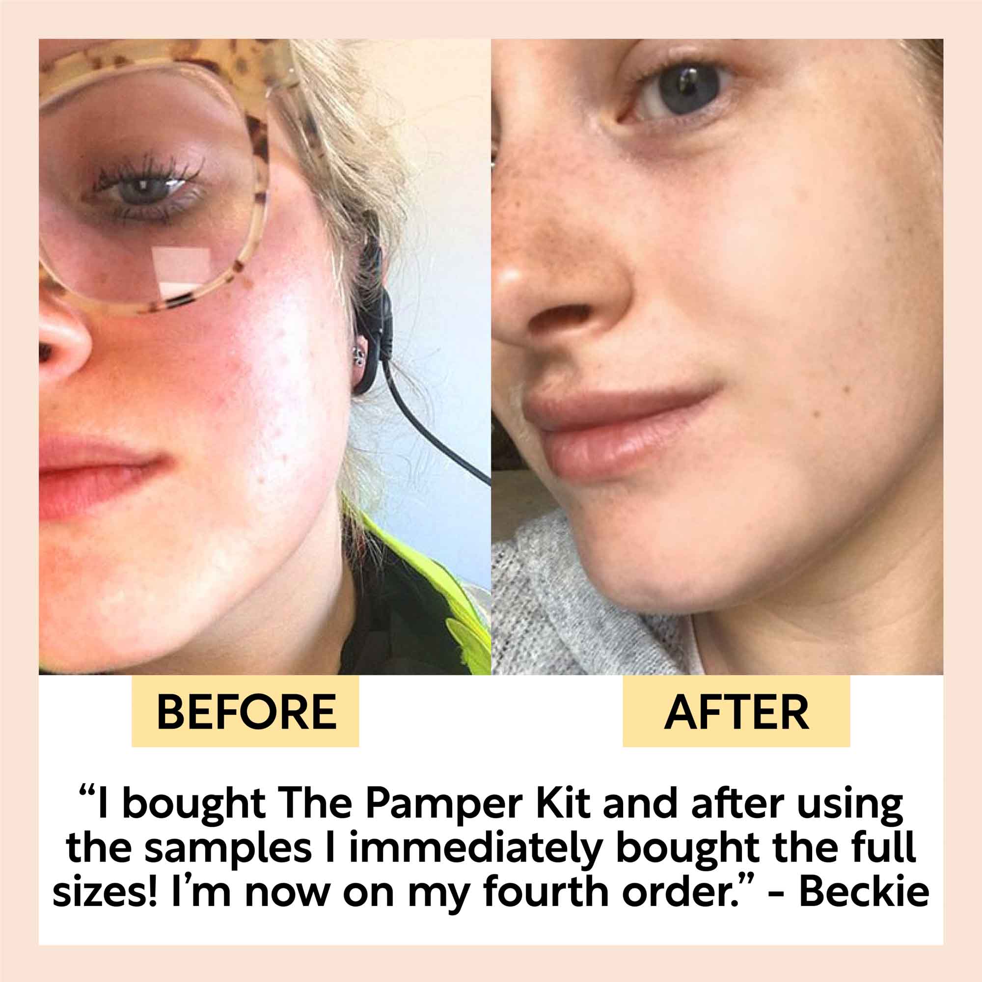 "Pamper + Gift" Skincare Kit